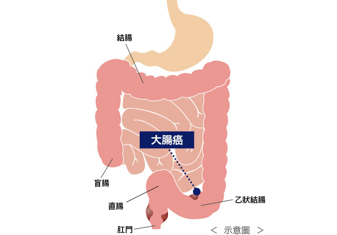 疾病介紹