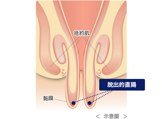 為什麼容易誤認？