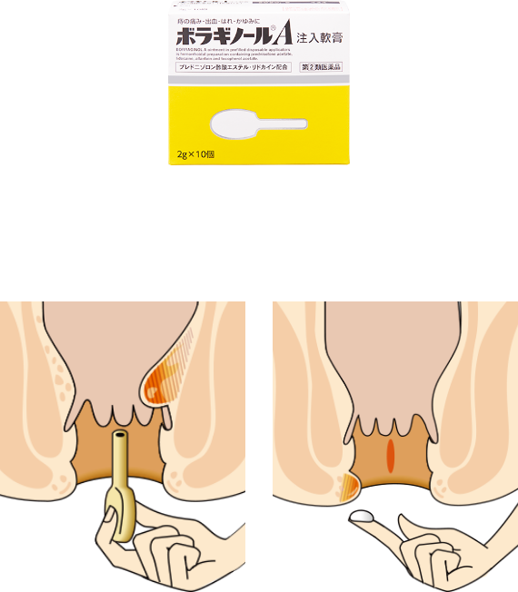 注入软膏