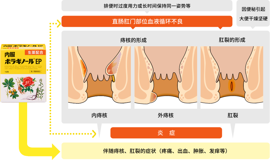 痔疮疾病内服药，生药配方