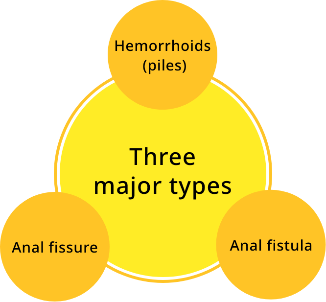 Three major types
