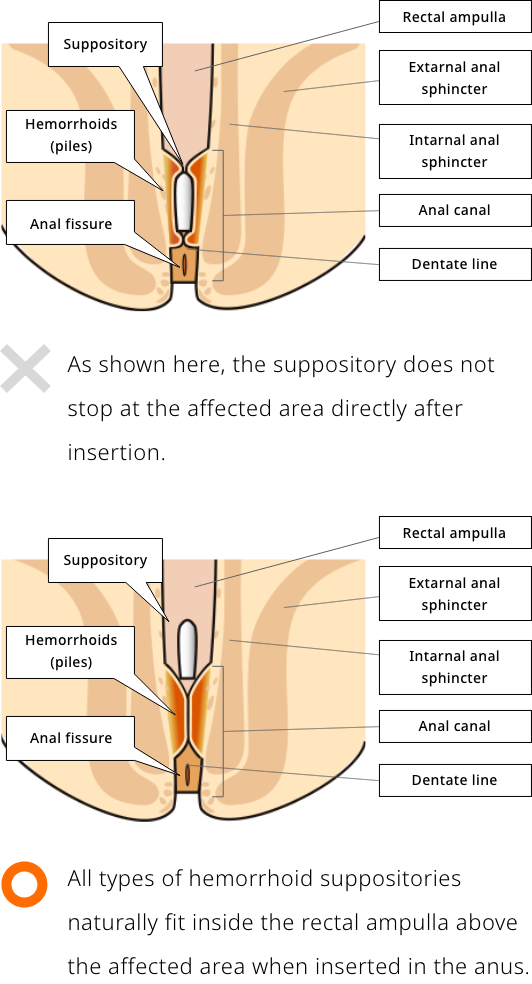 Image of the suppository does not stop at the affected area.