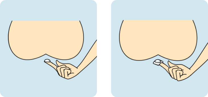 軟膏の使い方step2図