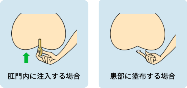 可自由选择2种使用方法