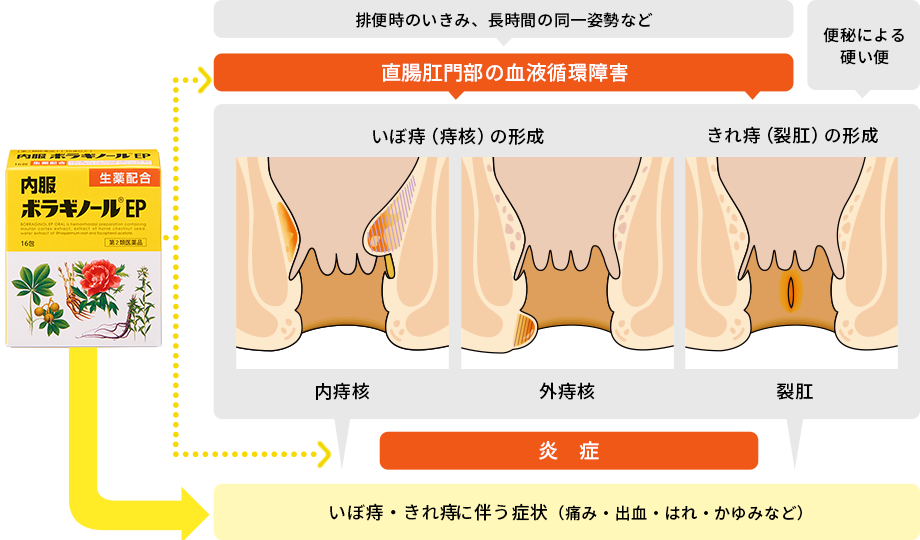 痔 の 薬 切れ