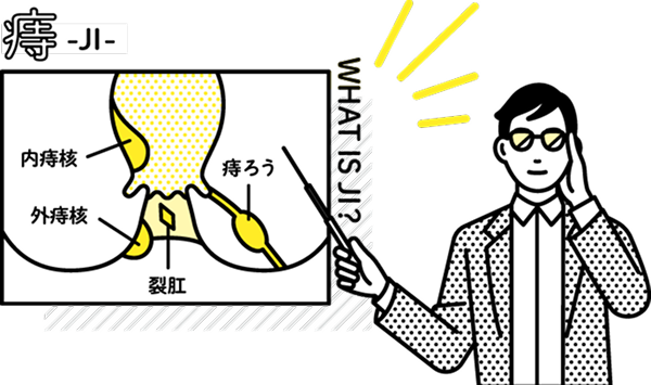 痔って一体どんなもの！？のイメージ図