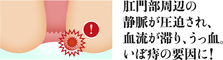 肛門部周辺の静脈が圧迫され、血流が滞り、うっ血。いぼ痔の要因に！