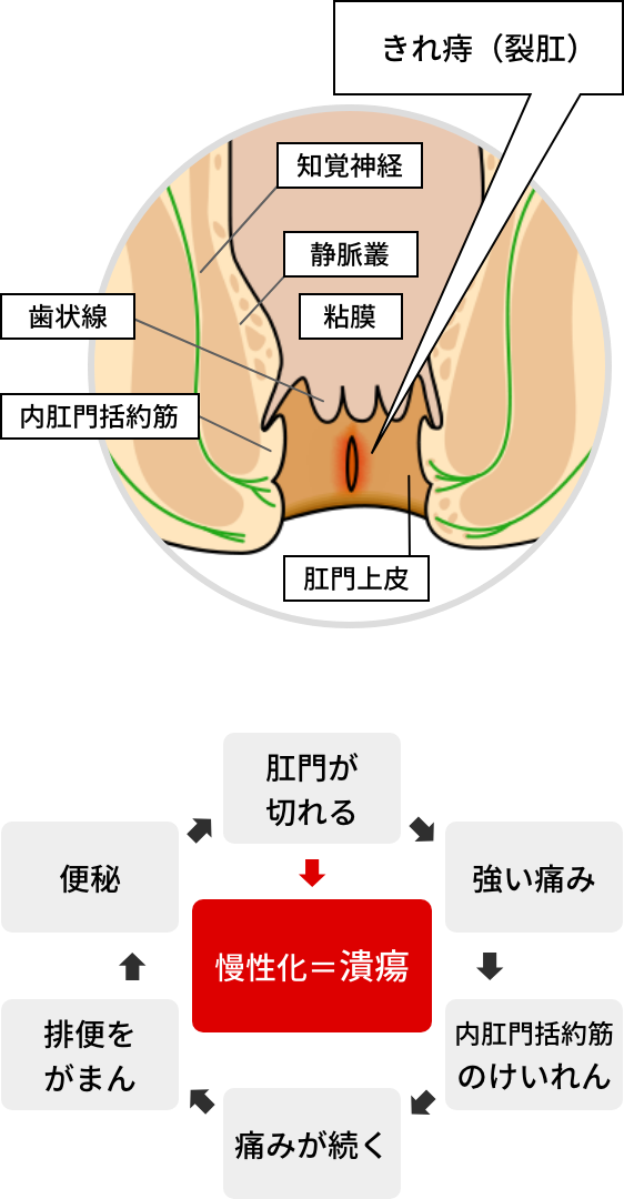 薬 切れ 痔 の